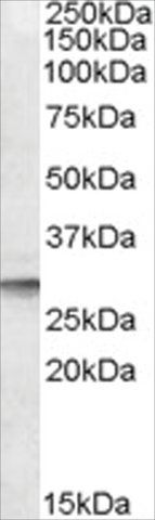 Anti-DPM1 (AB1) antibody produced in goat