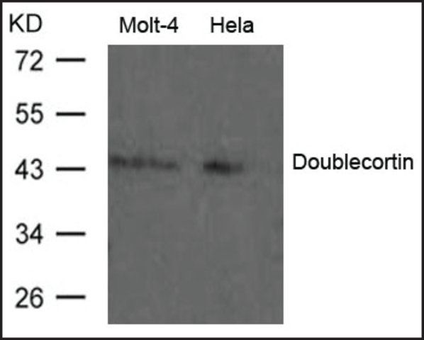 Anti-Doublecortin antibody produced in rabbit