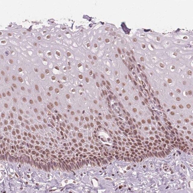 Anti-DPM2 antibody produced in rabbit