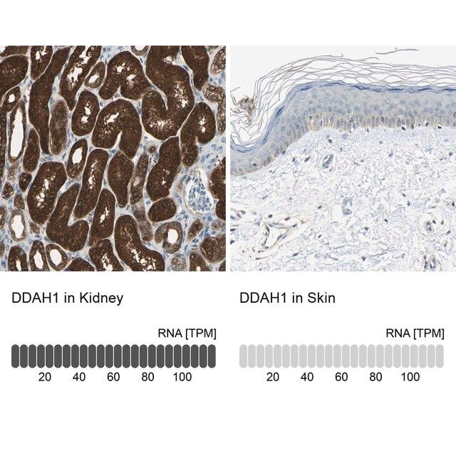 Anti-DDAH1 antibody produced in rabbit