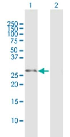 Anti-DCXR antibody produced in mouse