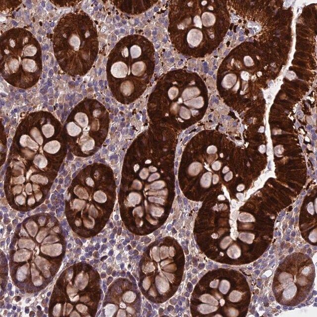 Anti-DCTN5 antibody produced in rabbit