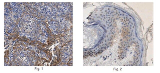 Anti-Desmoglein-3, clone 5G11 Antibody