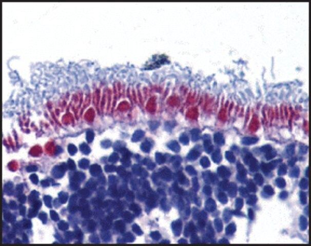 Anti-DFF45 antibody produced in rabbit