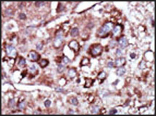 Anti-DGKZ (C-term) antibody produced in rabbit