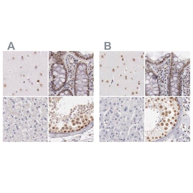 Anti-DGCR14 antibody produced in rabbit