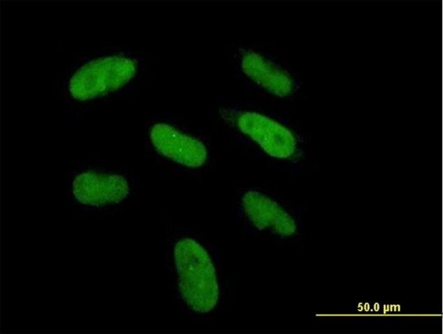 Anti-DGCR6 antibody produced in mouse