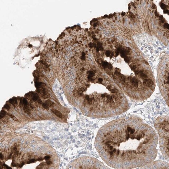 Anti-DGKQ antibody produced in rabbit