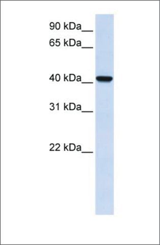 Anti-DGAT2L4 antibody produced in rabbit