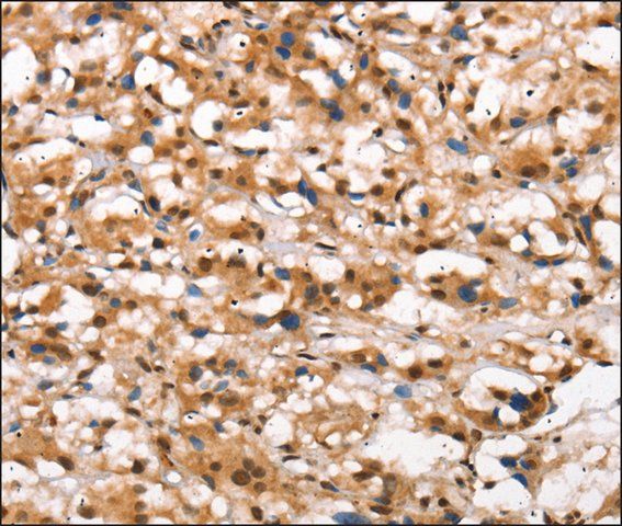 Anti-DGAT1 antibody produced in rabbit