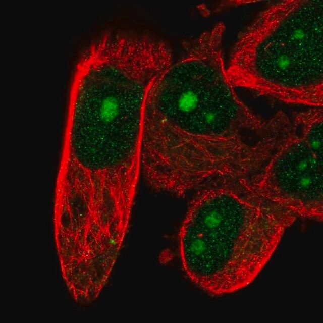 Anti-DFFB antibody produced in rabbit