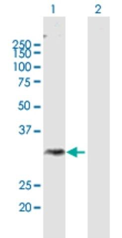 Anti-DGAT2L3 antibody produced in mouse