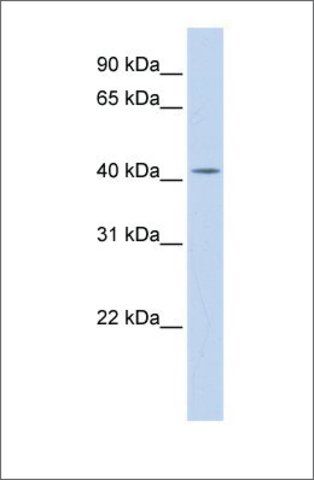 Anti-DHDDS antibody produced in rabbit