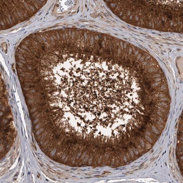 Anti-DHDDS antibody produced in rabbit