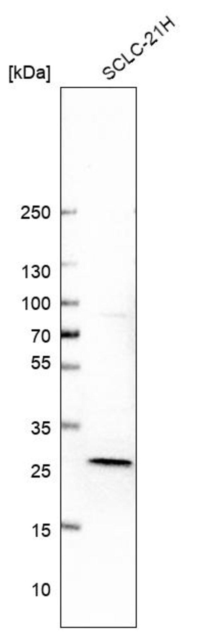 Anti-DGUOK antibody produced in rabbit