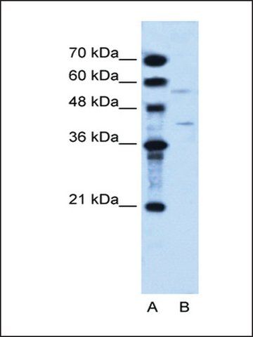 Anti-DHODH antibody produced in rabbit