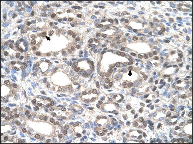 Anti-DFNA5 antibody produced in rabbit