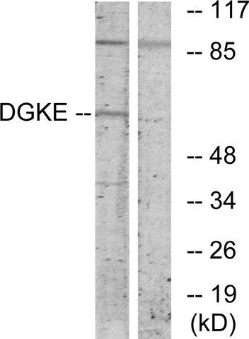 Anti-DGKE antibody produced in rabbit