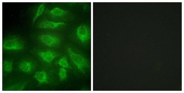 Anti-DGKI antibody produced in rabbit