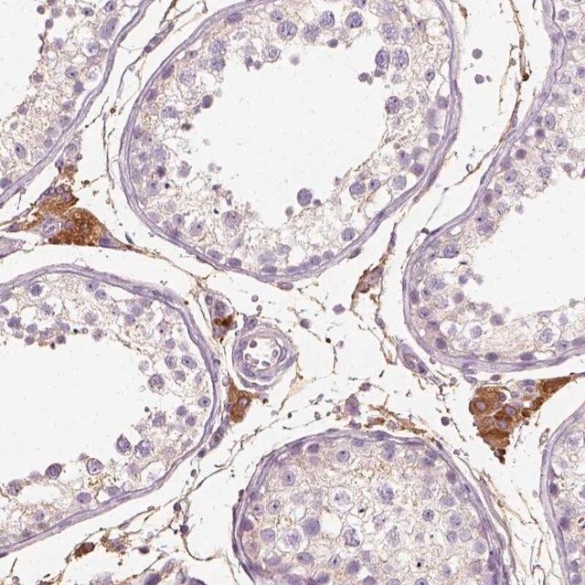 Anti-DHCR24 antibody produced in rabbit