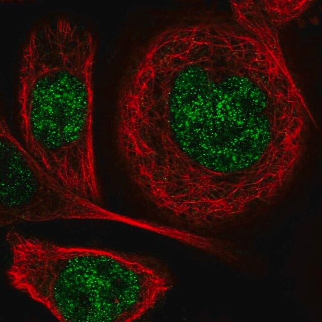 Anti-DGKI antibody produced in rabbit