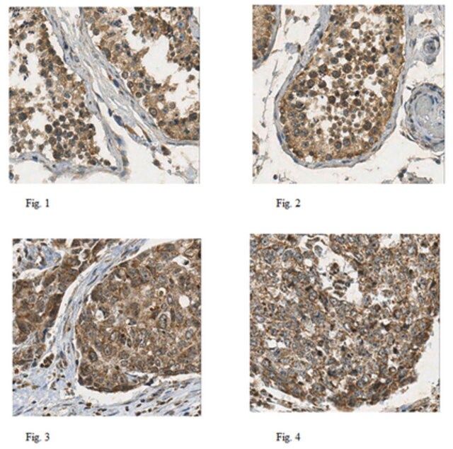 Anti-DHODH Antibody