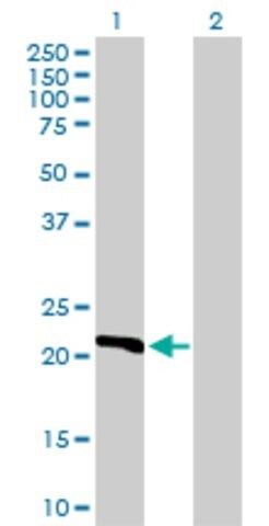 Anti-DHFR antibody produced in rabbit