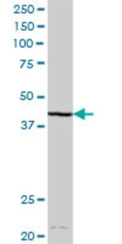 Anti-DHDH antibody produced in mouse