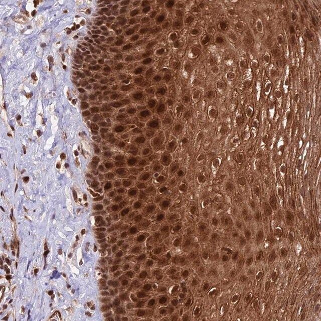 Anti-DHX38 antibody produced in rabbit