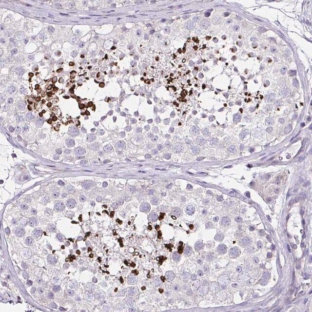 Anti-D2HGDH antibody produced in rabbit