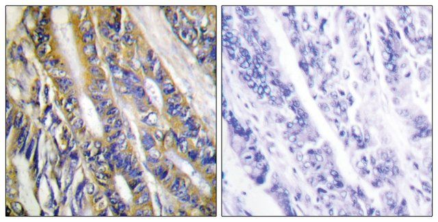 Anti-DGKH antibody produced in rabbit