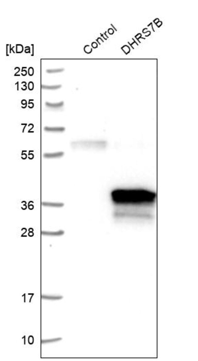 Anti-DHRS7B antibody produced in rabbit