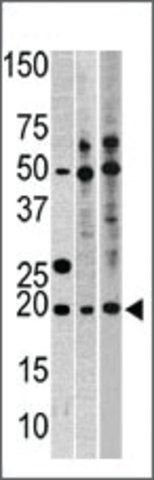 Anti-DHX15 (C-term) antibody produced in rabbit