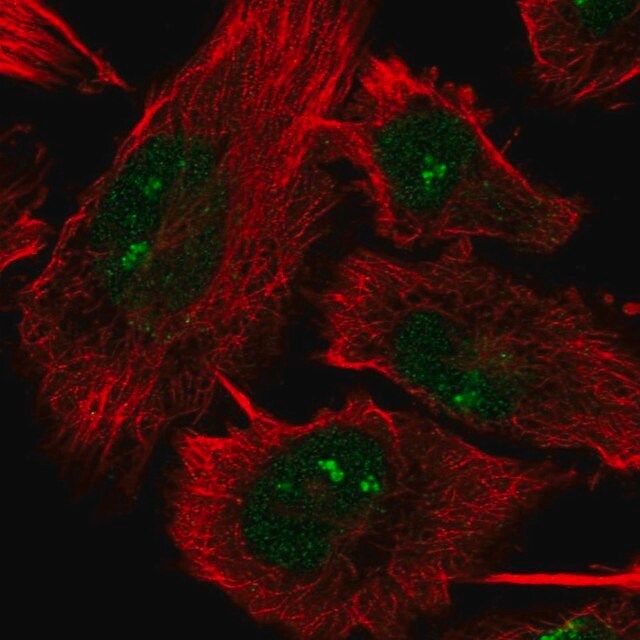 Anti-DHX33 antibody produced in rabbit