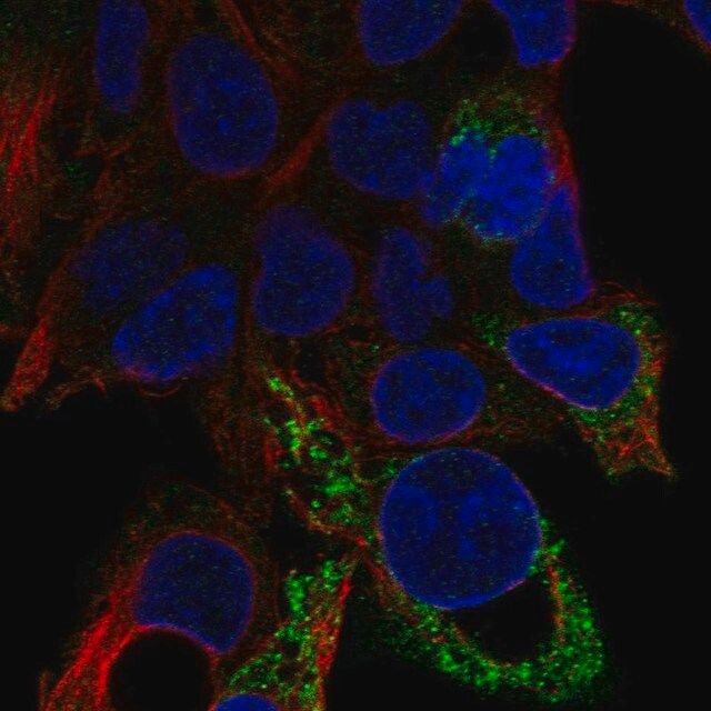 Anti-D2HGDH antibody produced in rabbit