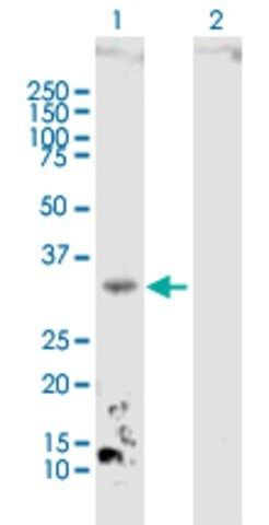 Anti-DHRS3 antibody produced in mouse