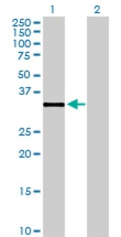 Anti-DHRS7B antibody produced in mouse