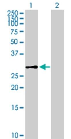 Anti-DHDDS antibody produced in mouse