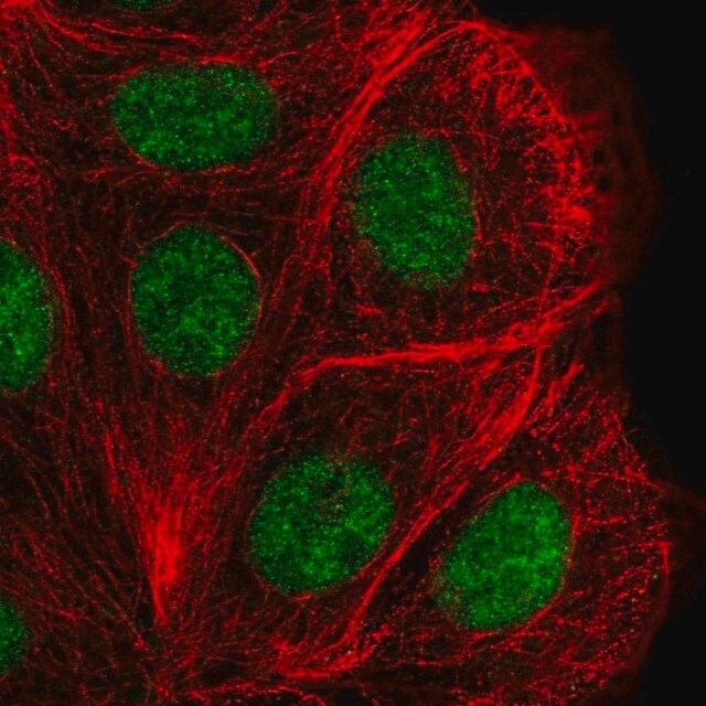 Anti-DHX38 antibody produced in rabbit