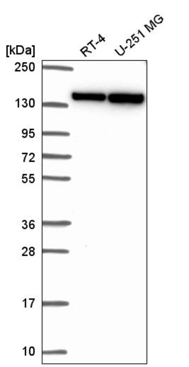 Anti-DHX9 antibody produced in rabbit