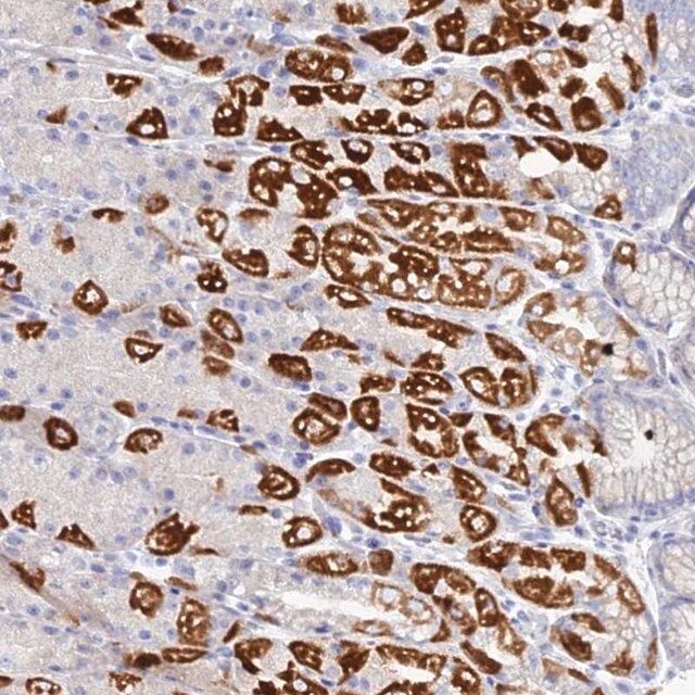 Anti-DHX34 antibody produced in rabbit