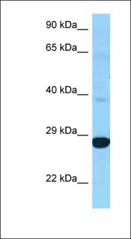 Anti-DHRS4L2 antibody produced in rabbit