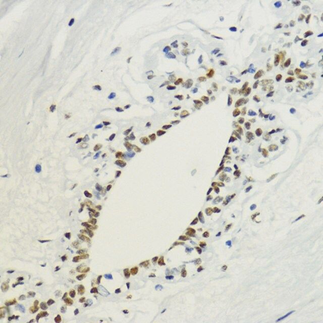 Anti-DiMethyl-Histone H3-K36 antibody produced in rabbit