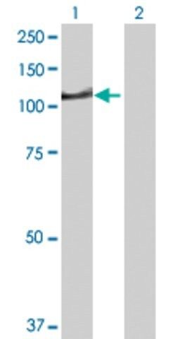 Anti-DIP2A antibody produced in rabbit