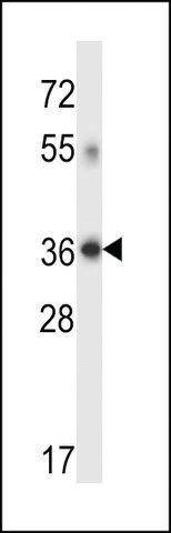 ANTI-DHRS7C (CENTER) antibody produced in rabbit