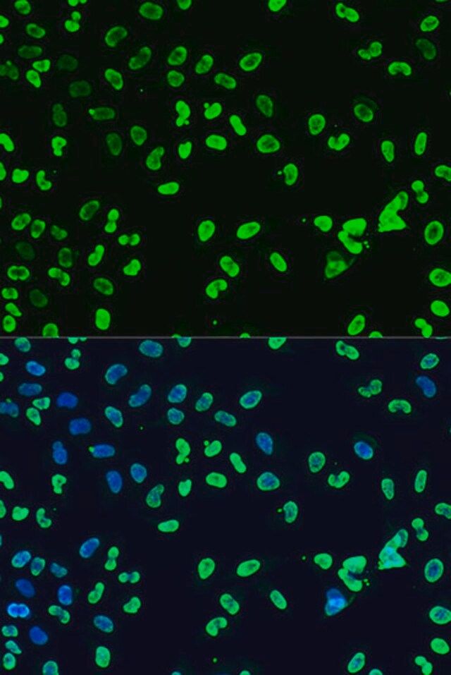 Anti-DiMethyl-DNMT3A-K44 antibody produced in rabbit