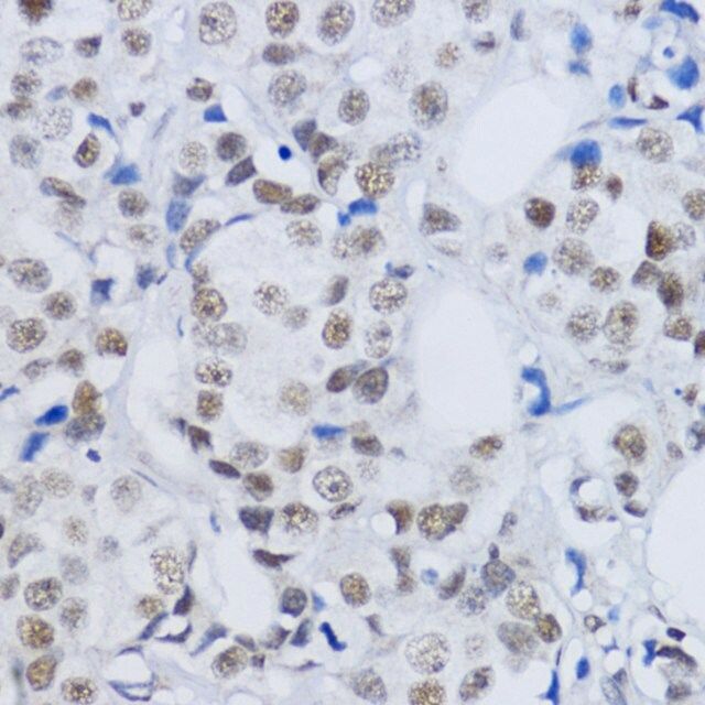 Anti-DiMethyl-Histone H3-K79 antibody produced in rabbit