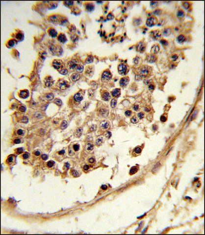 ANTI-CXCR7 (C-TERM) antibody produced in rabbit