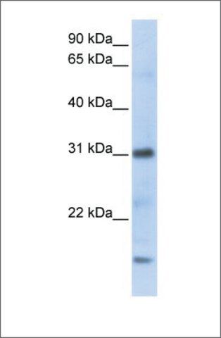 Anti-CXCL16 antibody produced in rabbit