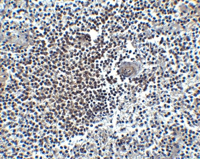 Anti-CXCR4 antibody produced in rabbit